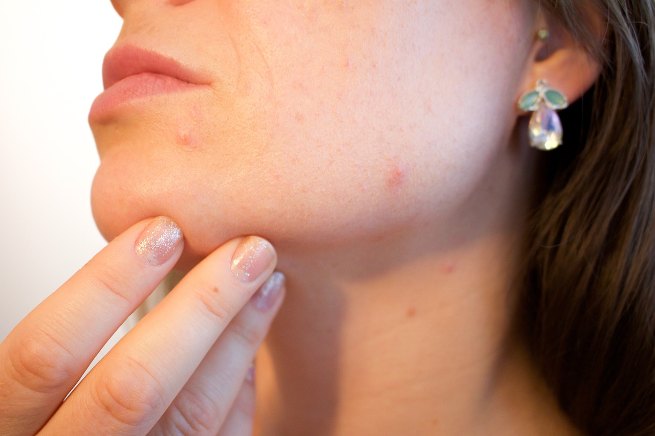 Lenfoma ve Dermatoloji Uzmanı: Erken Teşhis ve Tedavi Sürecindeki Rolü